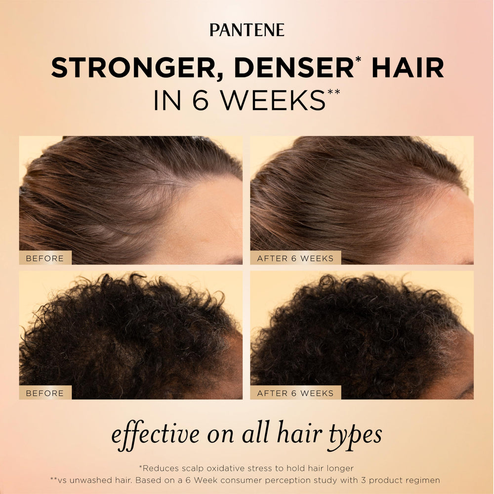 Pantene scalp and root serum dropper detail emphasizing precise, non-greasy application