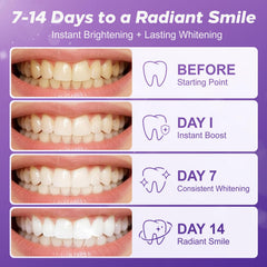 Pdoo strip close-up on teeth demonstrating secure fit and non-slip benefit