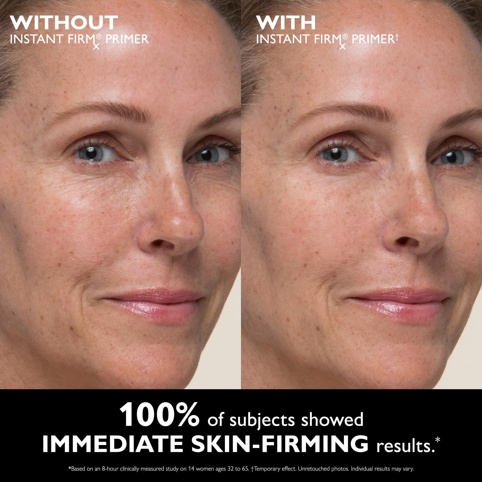 Peter Thomas Roth before and after comparison showing reduced pores benefit: visibly refined texture
