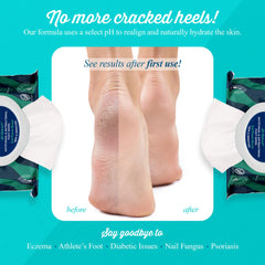 pHeet opened pouch display revealing neatly stacked, pre-moistened wipes ready to use