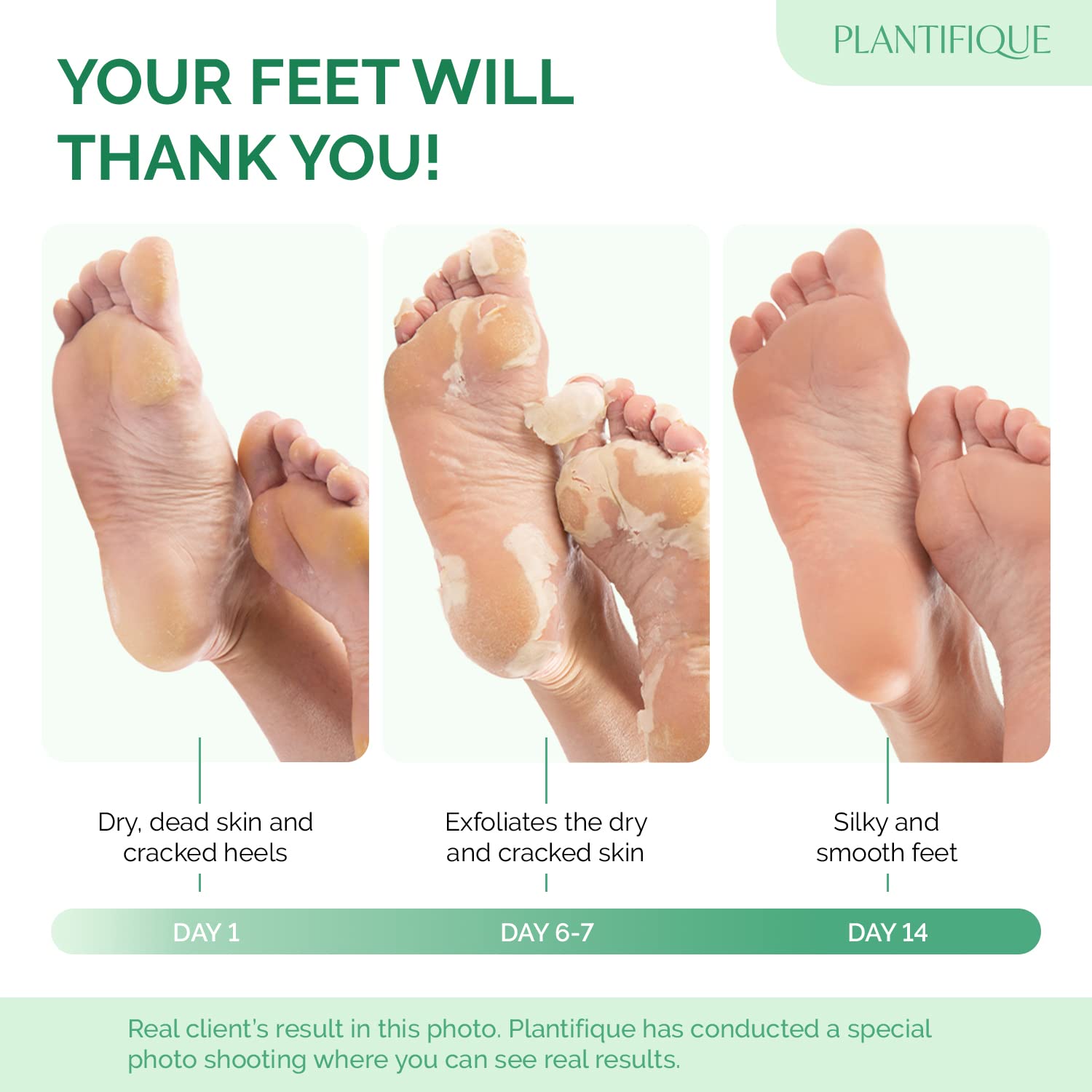 PLANTIFIQUE close-up of the bootie material and sealed inner pad for controlled exfoliation