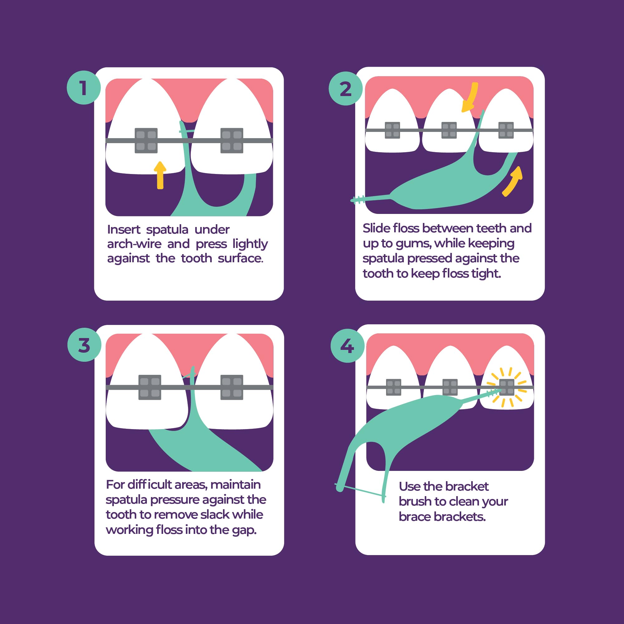 Platypus pick tip detail highlighting debris removal around brackets