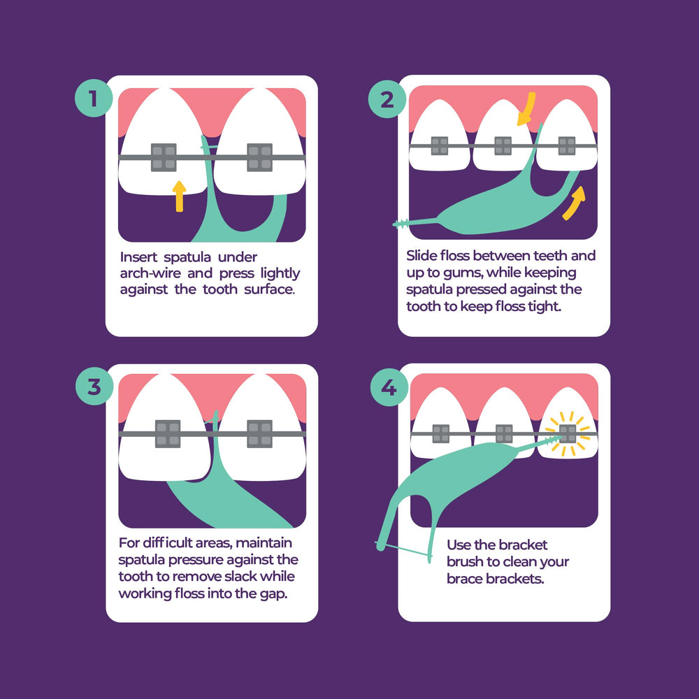 Platypus pick tip detail highlighting debris removal around brackets