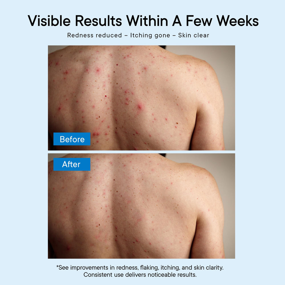 ProBliva foaming on skin demonstrating deep cleanse and cooling menthol