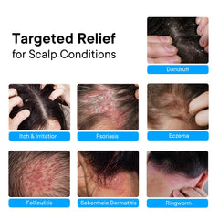 ProBliva spray texture mist illustrating fast-absorbing, lightweight feel on scalp