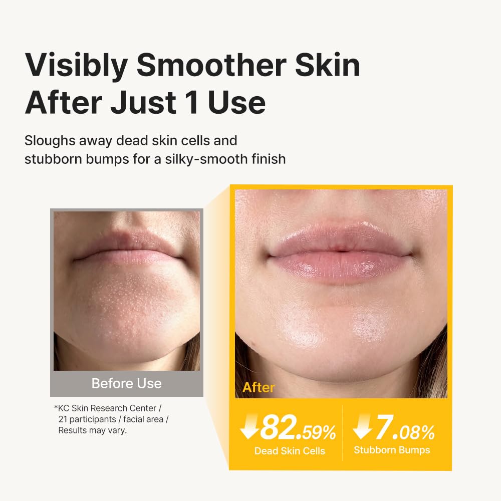 RETURNITY mask rinsed off before moisturizer illustrating hydrated finish