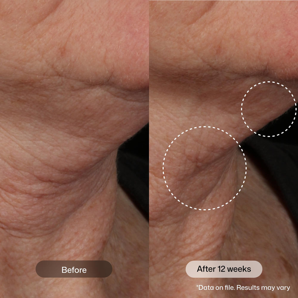 Revision Skincare being applied to neck to visibly firm and lift skin