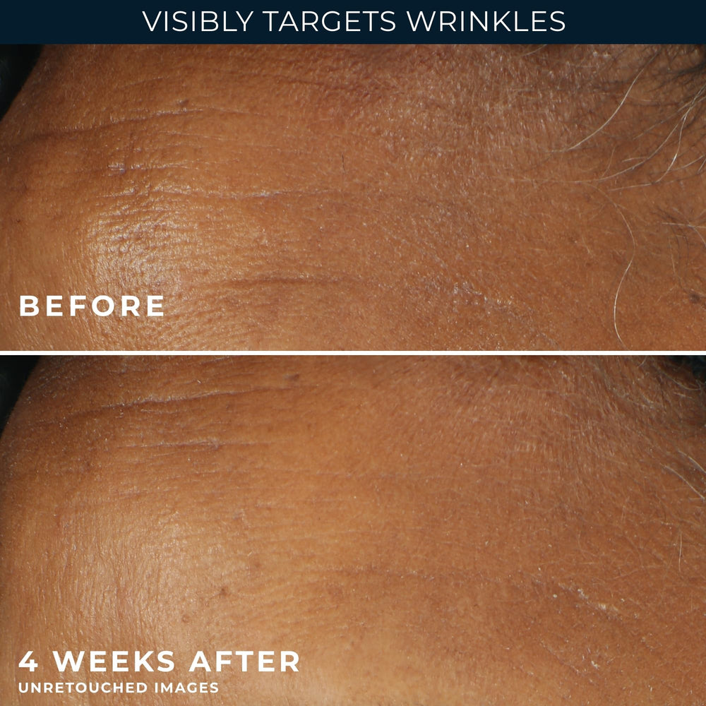 RoC ingredients label highlighting retinol and sunscreen protection