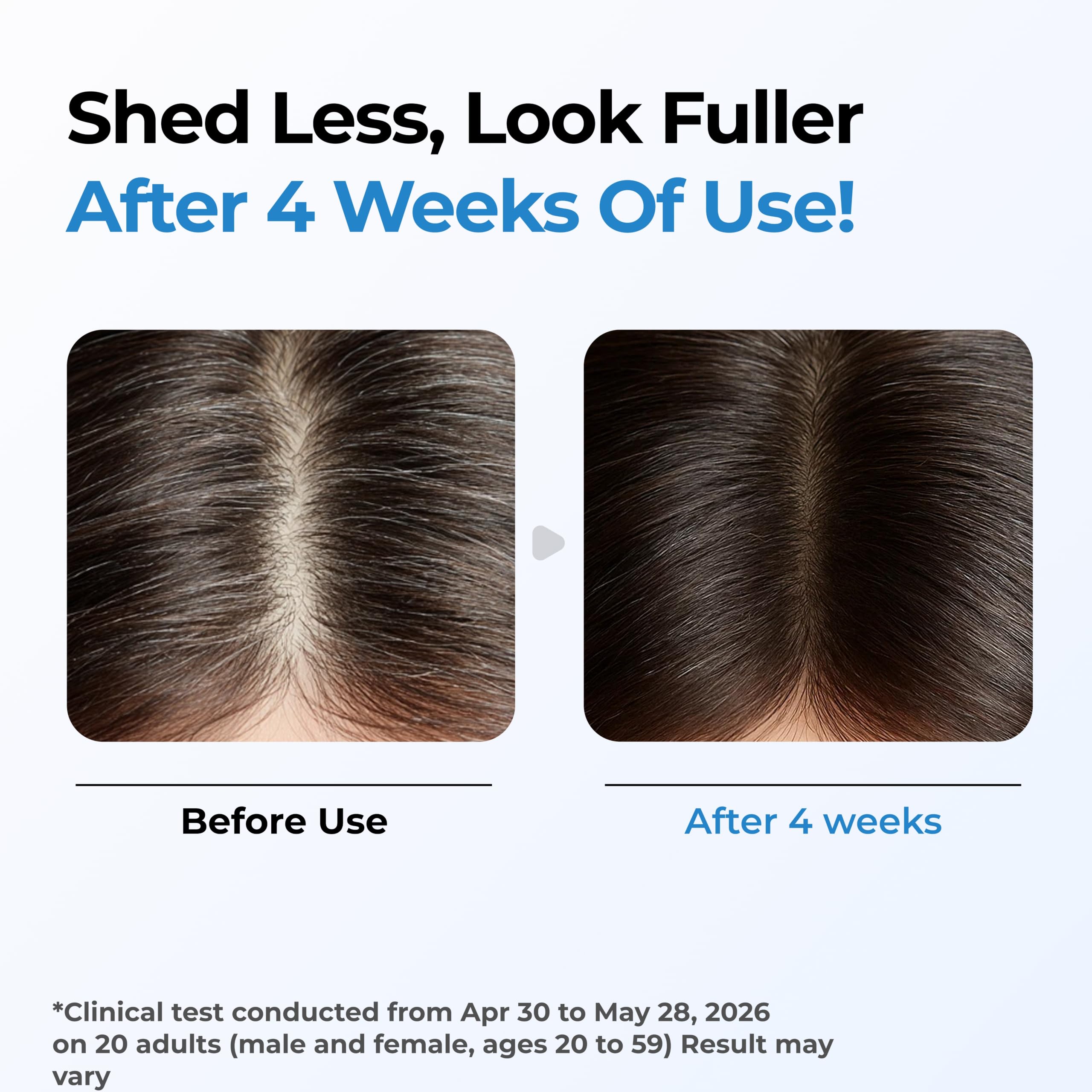 Seapuri before and after scalp area showing fuller appearance