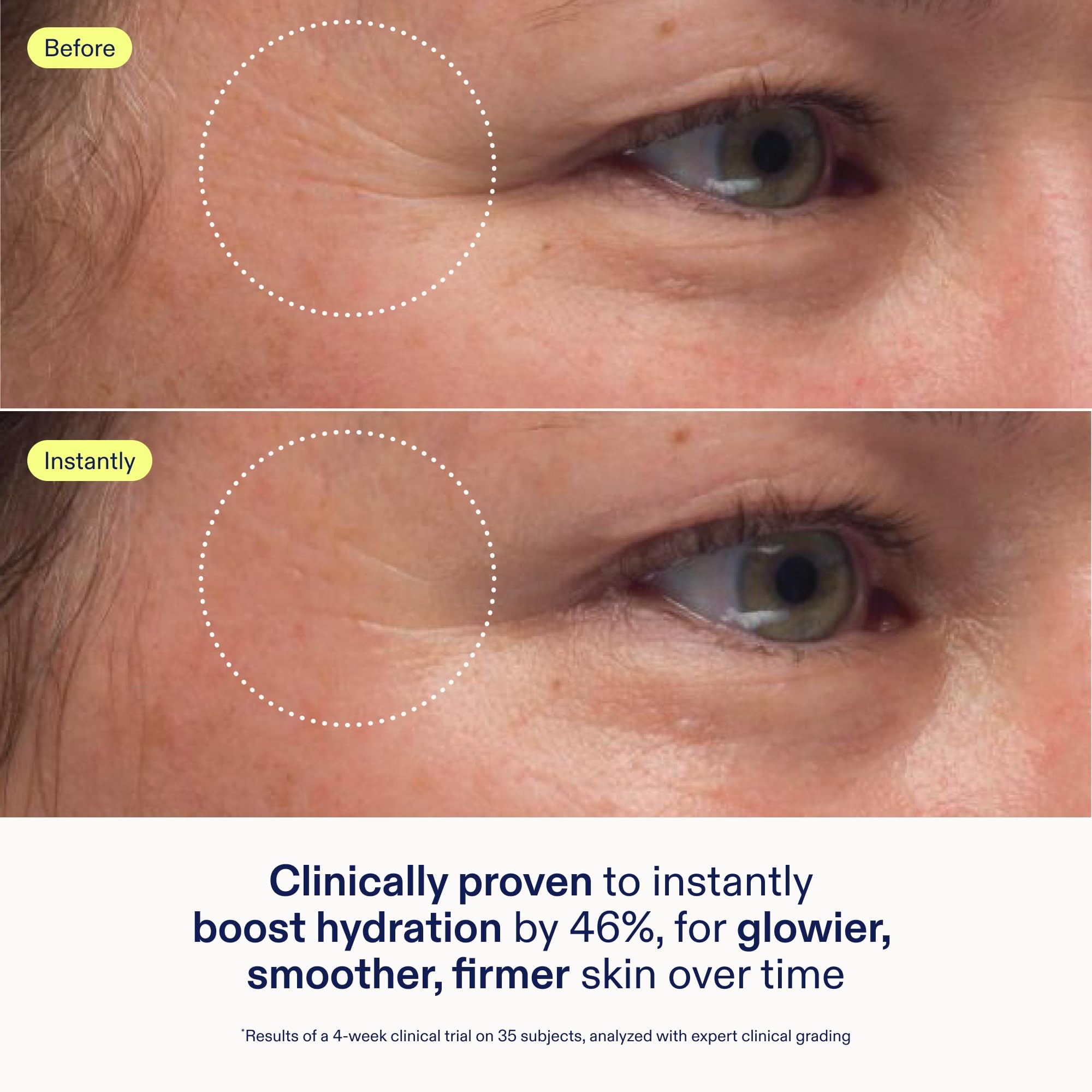 Hand applying Skinfix moisturizer demonstrating smooth application and barrier support