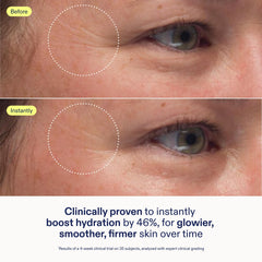 Hand applying Skinfix moisturizer demonstrating smooth application and barrier support
