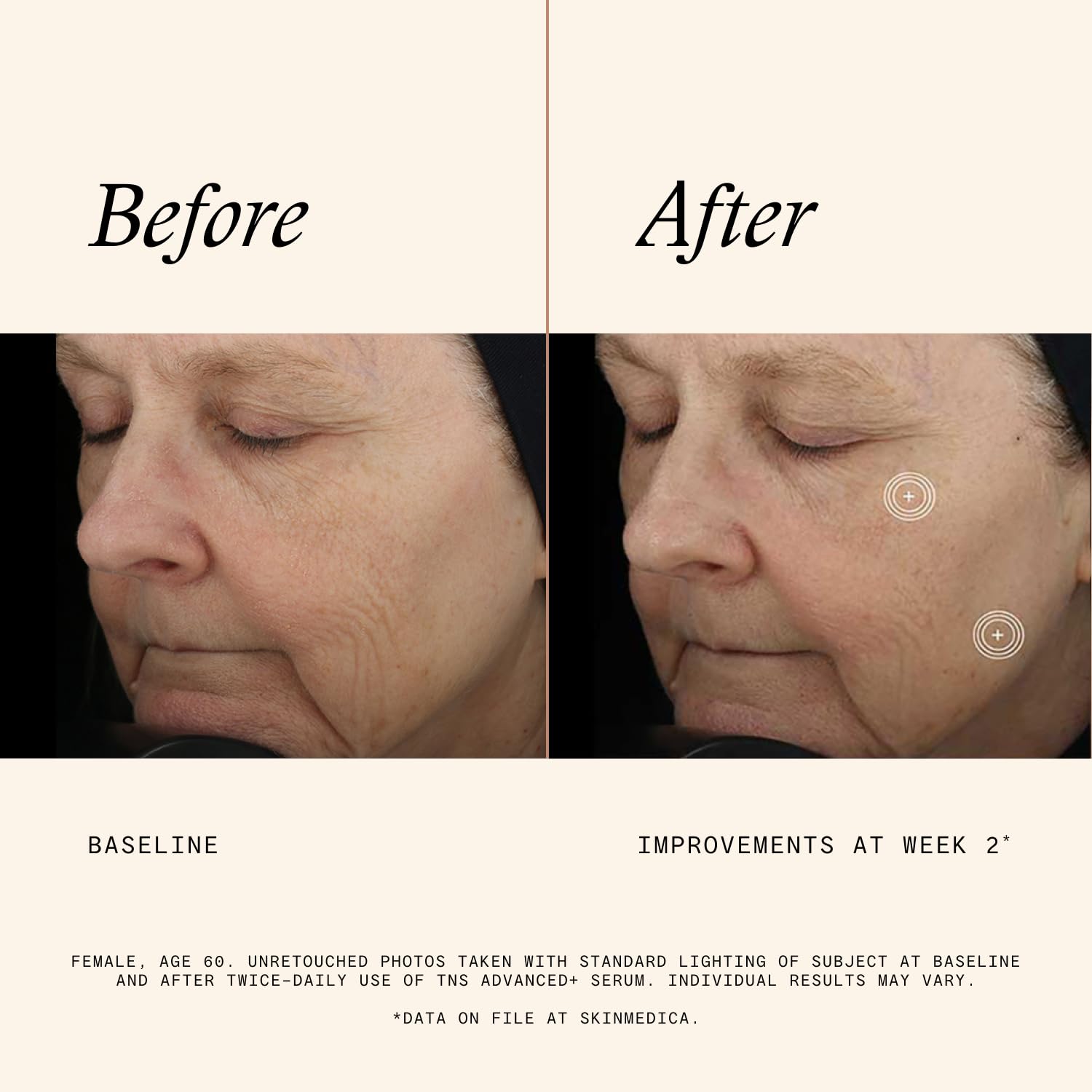 SkinMedica serum on hand for scale, illustrating recommended amount and easy application