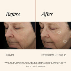 SkinMedica serum on hand for scale, illustrating recommended amount and easy application