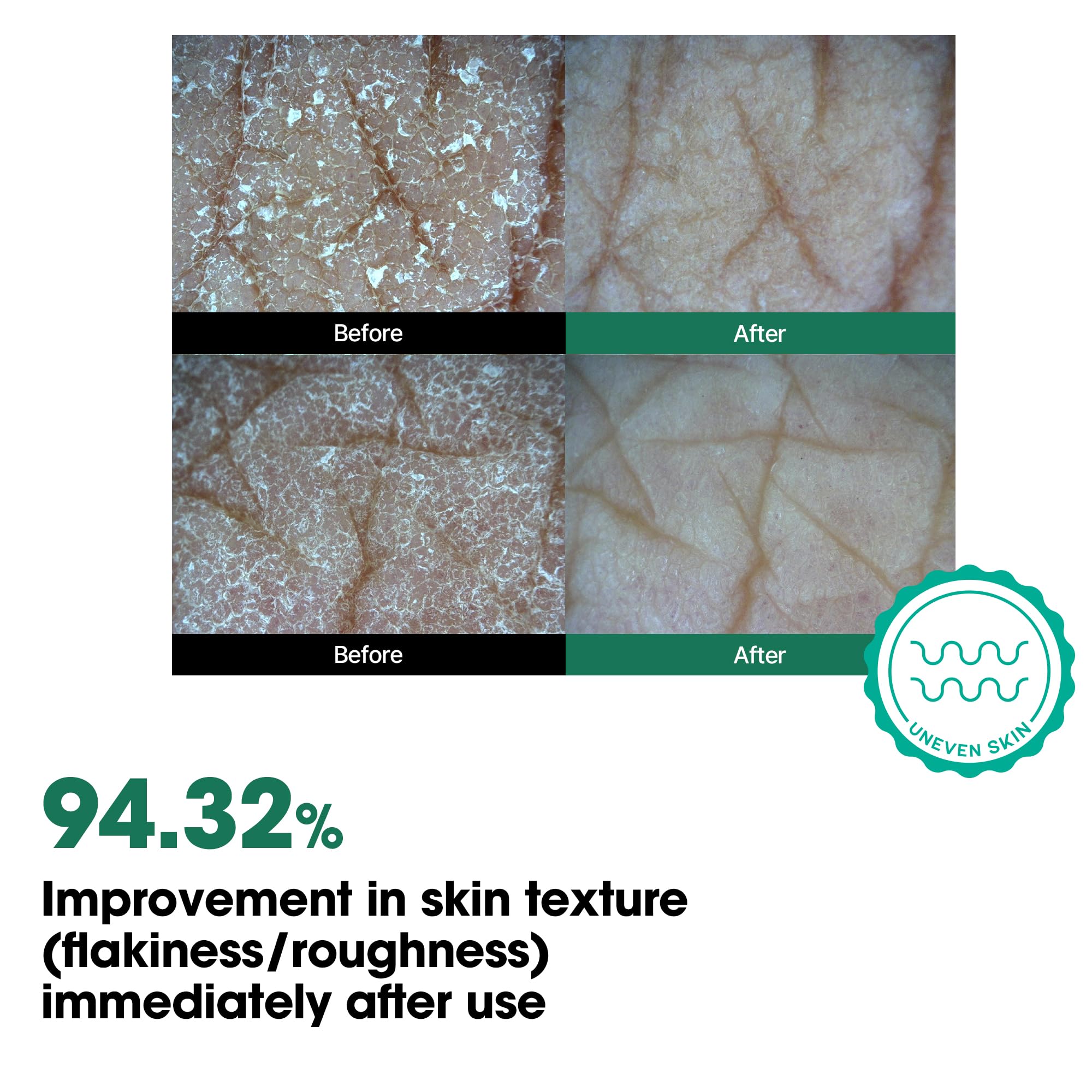 SOME BY MI tea tree and niacinamide imagery emphasizing soothing and brightening support