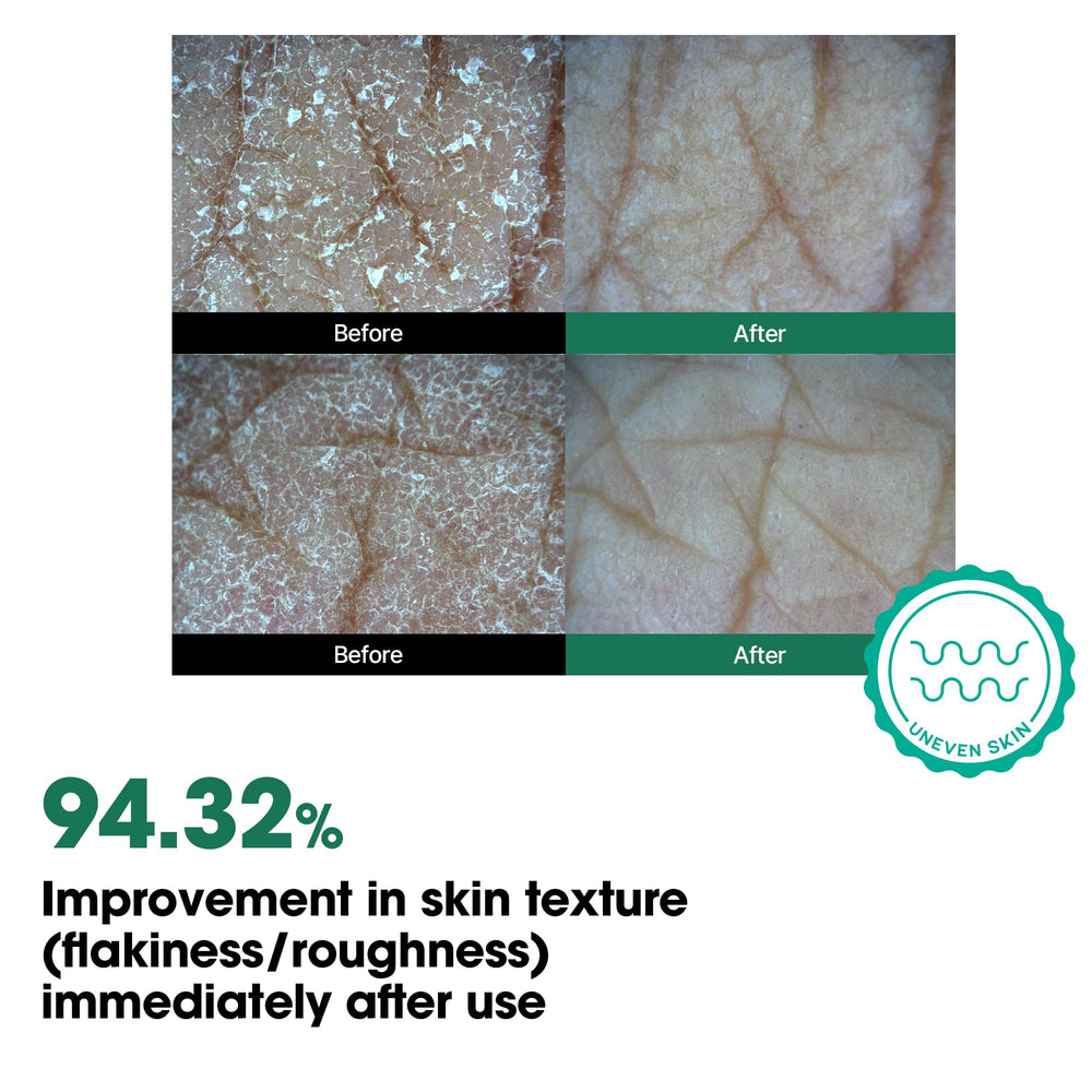 SOME BY MI tea tree and niacinamide imagery emphasizing soothing and brightening support