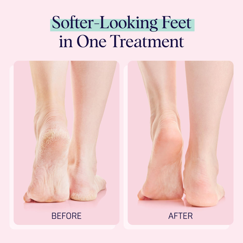 SpaLife foot sockies on feet demonstrating comfortable, non-drip wear