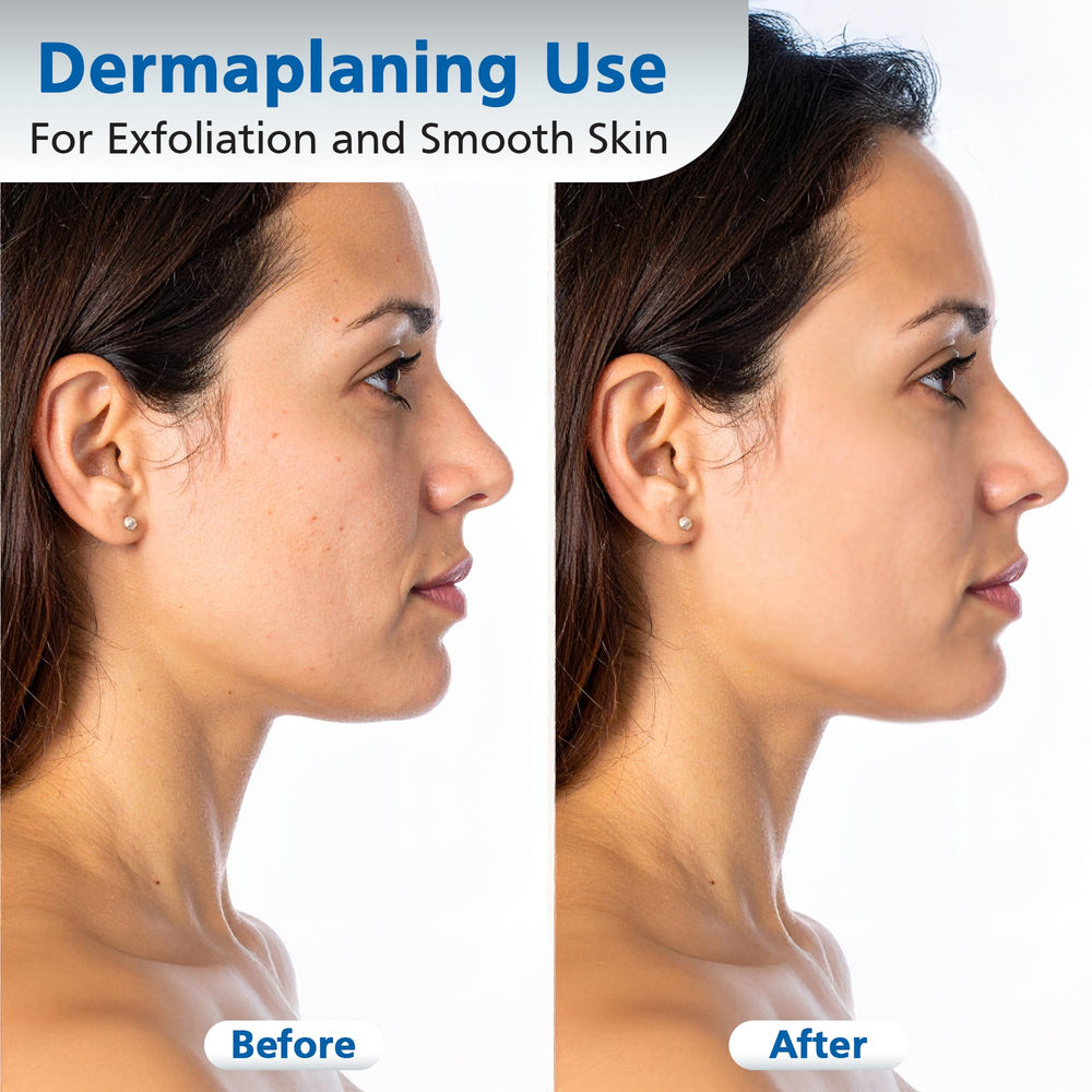 Swann-Morton #10R blade mounted in a dermaplane handle for controlled treatments