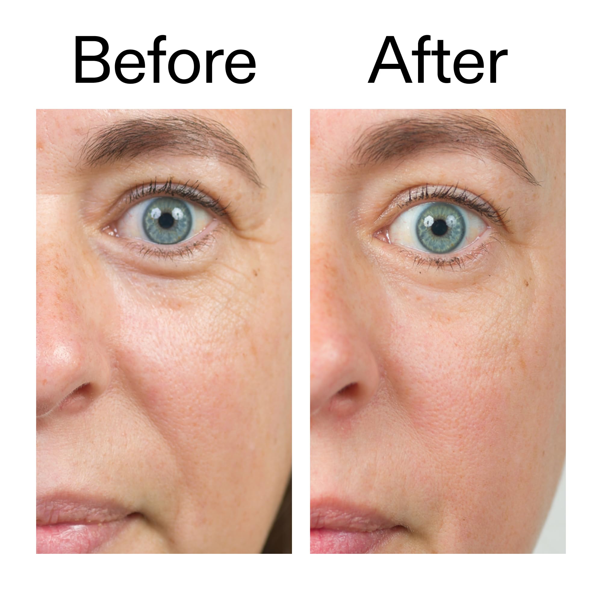 The INKEY List before and after close-up showing improved texture benefit