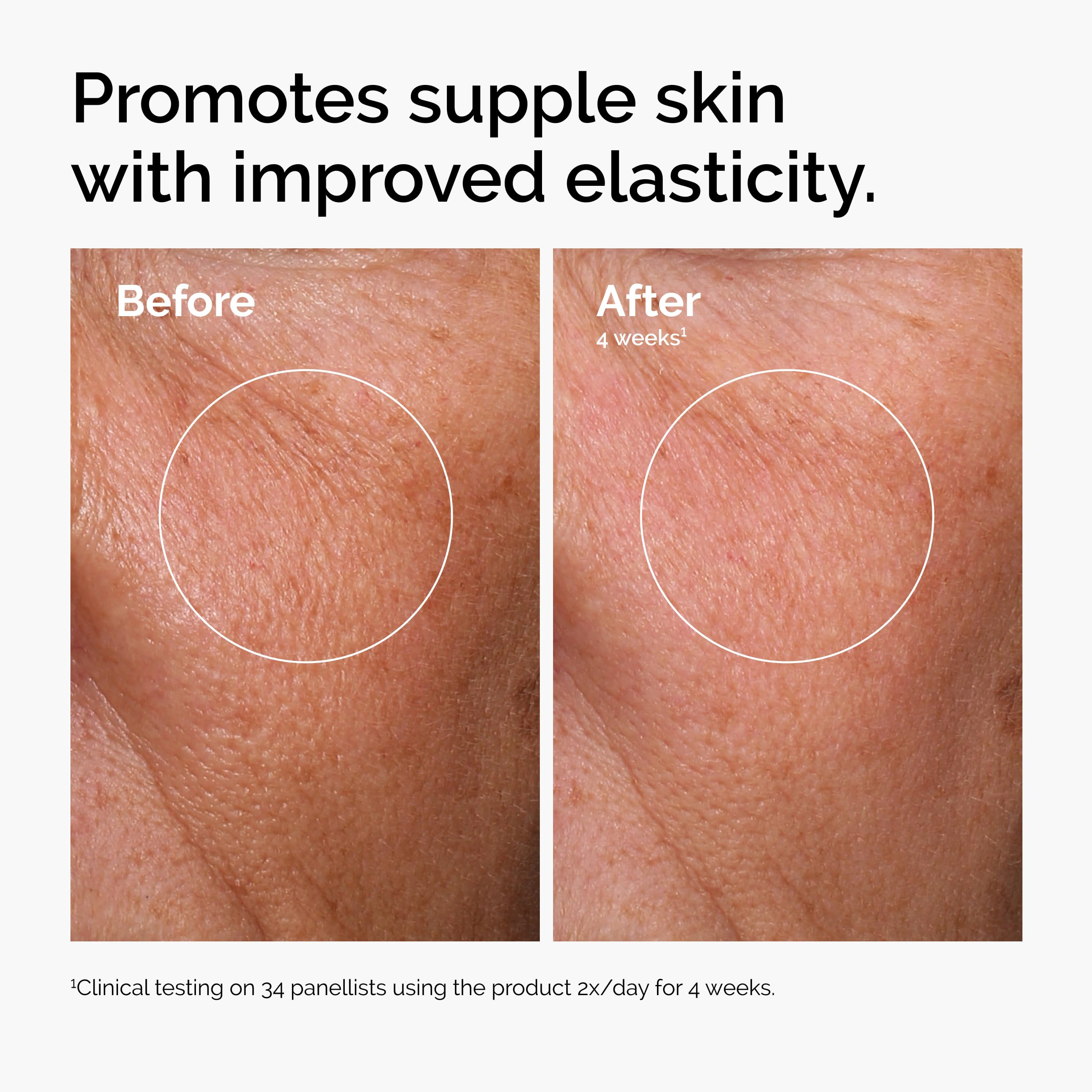 The Ordinary niacinamide dropper detail showing precision and pore-refining benefit