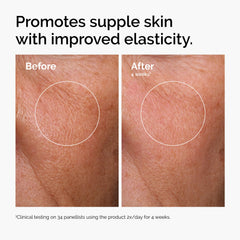 The Ordinary niacinamide dropper detail showing precision and pore-refining benefit