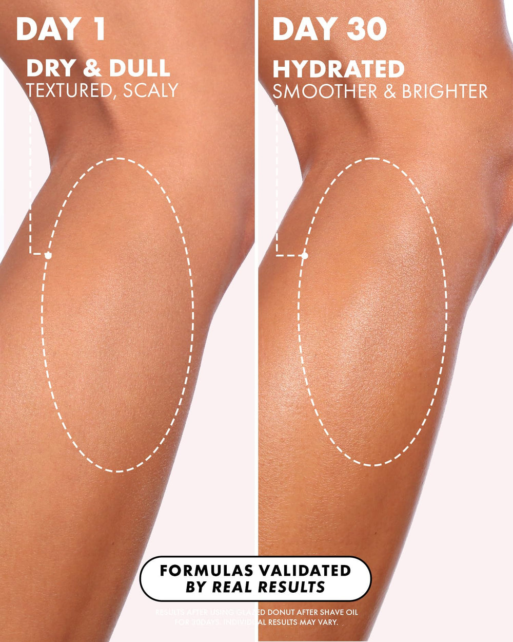 Truly bottle beside razor demonstrating post-shave use to prevent bumps