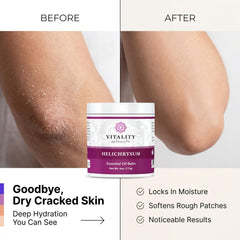 Vitality balm being applied to hand to show deep hydration and absorption