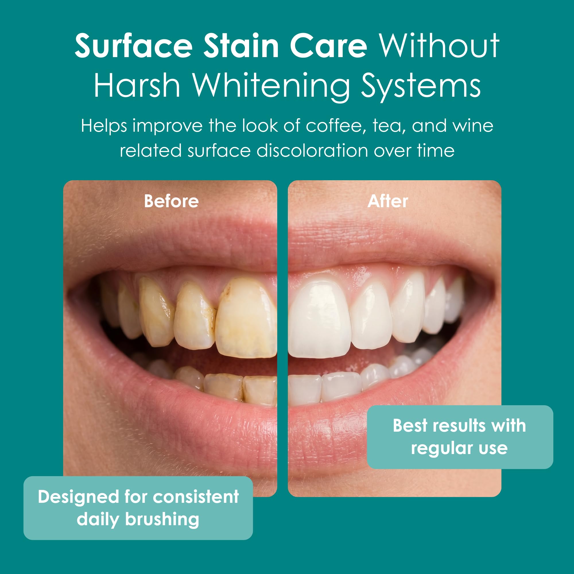 Wellnesse toothpaste cream close-up showing smooth texture for comfortable brushing
