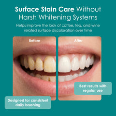 Wellnesse toothpaste cream close-up showing smooth texture for comfortable brushing