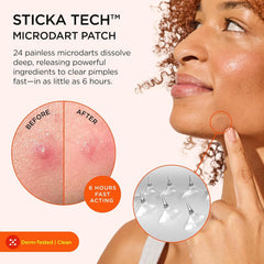 ZitSticka close-up of a single Killa patch highlighting discreet design and coverage
