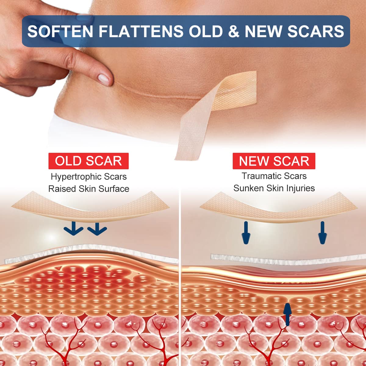 ZODENIS cut-to-size strip laid flat demonstrating customizable sizing benefits