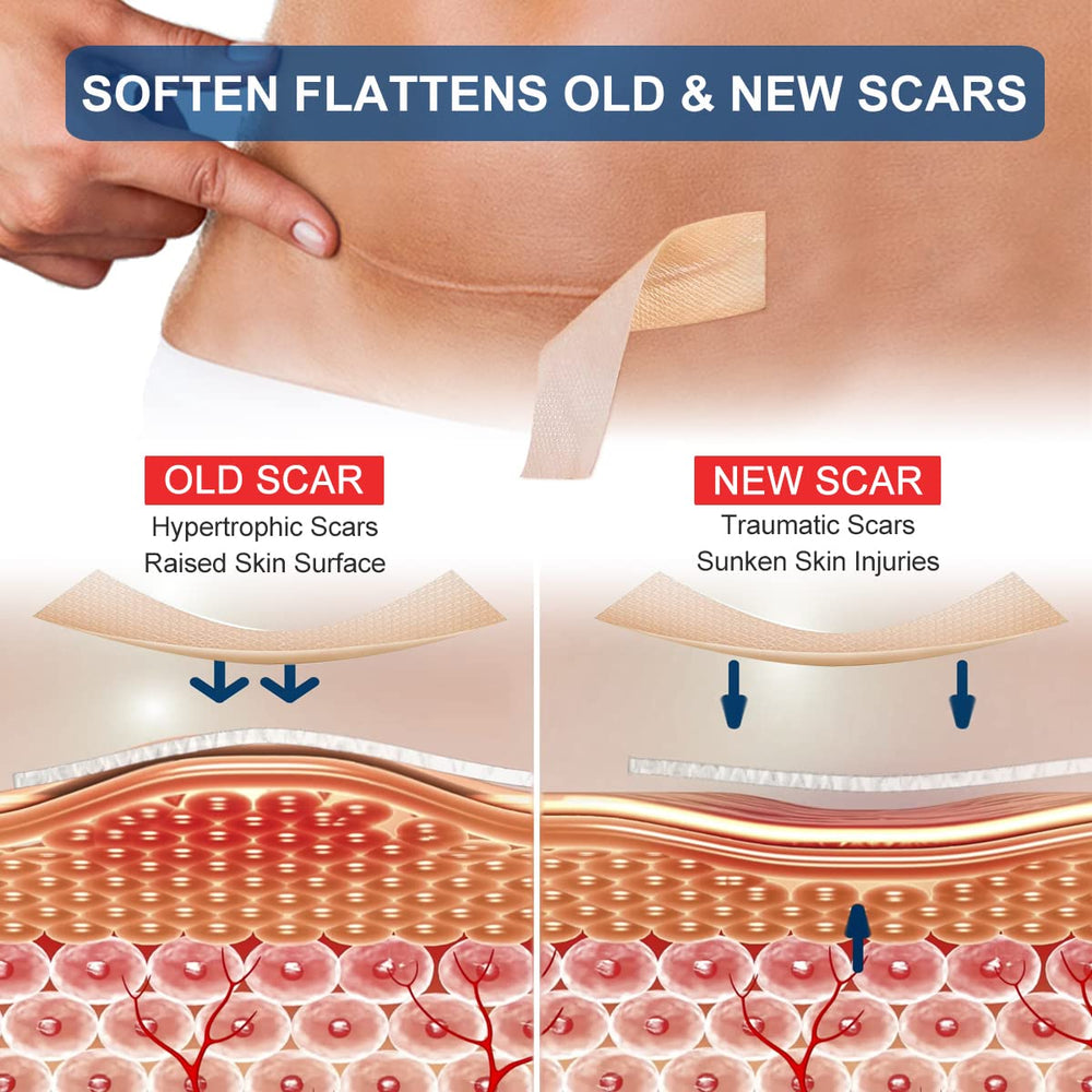 ZODENIS cut-to-size strip laid flat demonstrating customizable sizing benefits