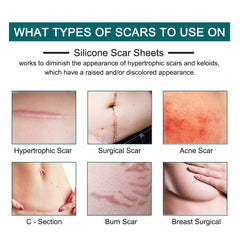 ZODENIS silicone close-up texture highlighting soft medical-grade feel and comfort